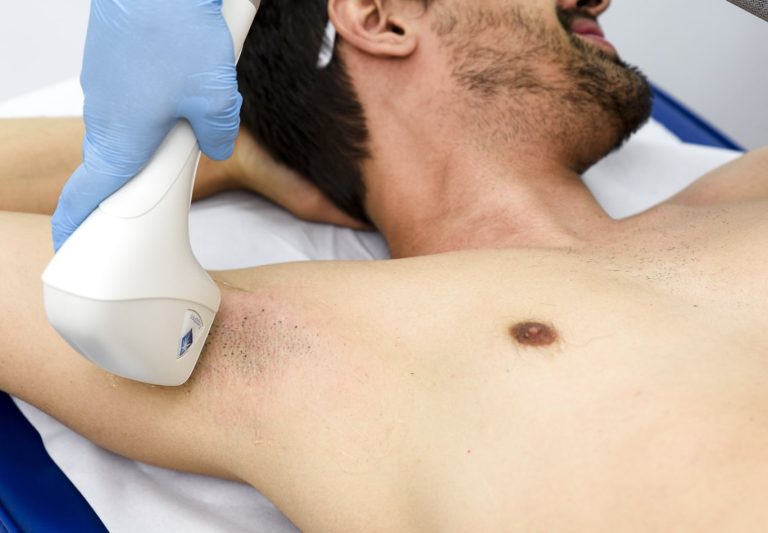 depilacao masculina