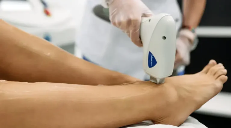 Mitos falsos sobre depilação a laser desmentidos