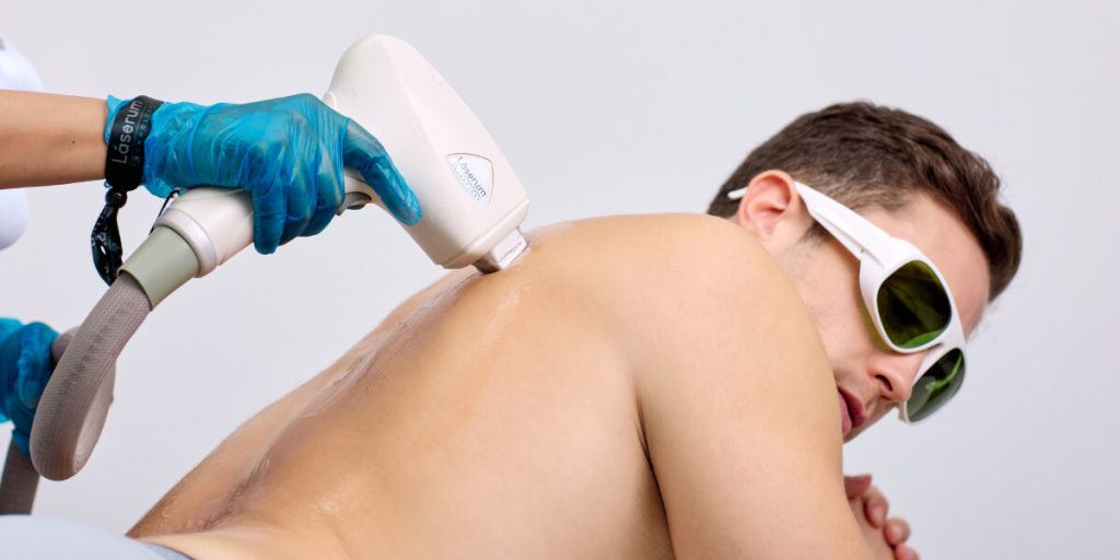 Informações sobre hipertricose e tratamento com depilação a laser