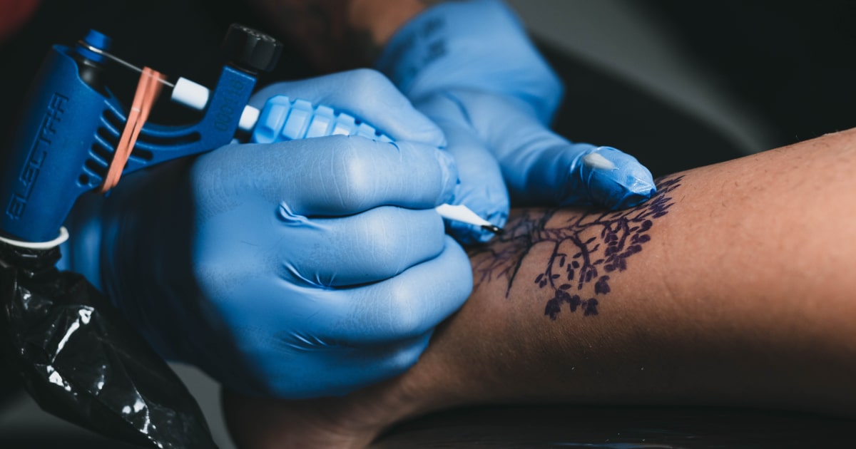 depilacion laser sobre tatuajes