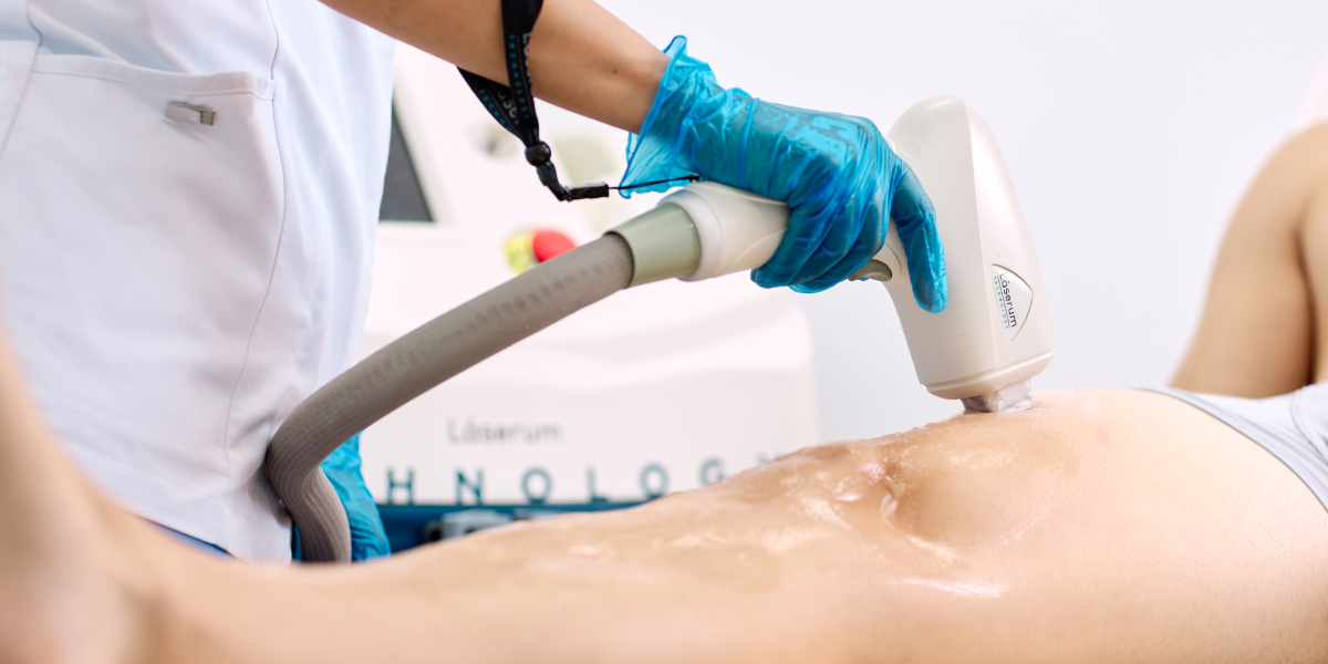tecnologia-propia-maquinas-de-depilacion-laser