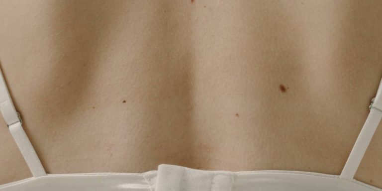 depilação a laser e sinais