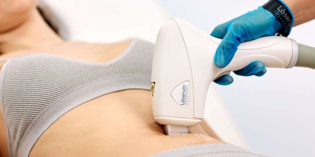tratamento laser definitivo