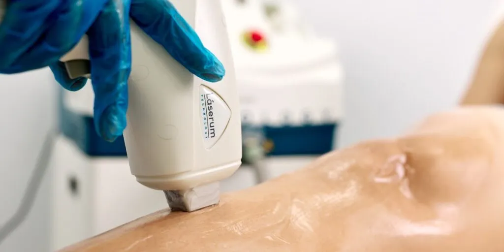 depilação a laser e ciclismo